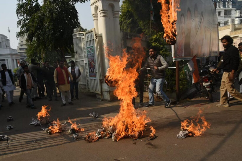 Lucknow News: पुतला दहन के दौरान आग की चपेट में आने से झुलसा NSUI कार्यकर्ता