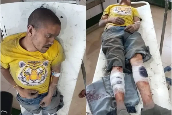Kashipur: यूट्यूबर बिरजू मयाल पर हमला, काशीपुर के हल्दुआ क्षेत्र में मारपीट