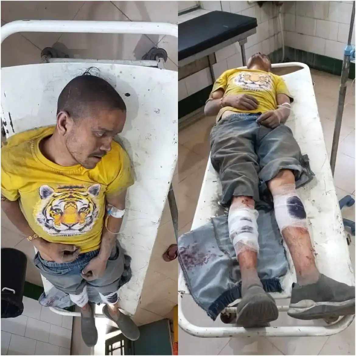 Kashipur: यूट्यूबर बिरजू मयाल पर हमला, काशीपुर के हल्दुआ क्षेत्र में मारपीट