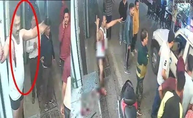 Nainital: नशे में होटल का शीशा तोड़ा, खुद ही हुआ लहूलुहान, लगे 70 टांके