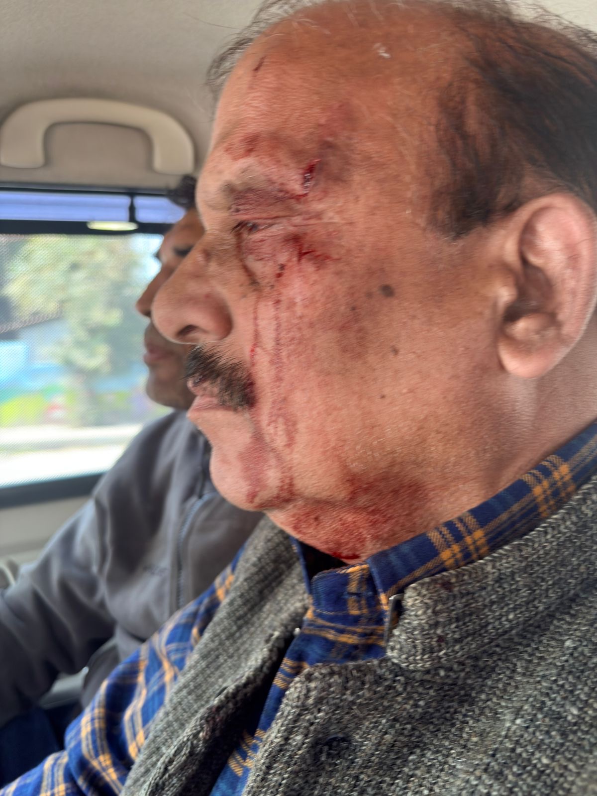 Dehradun: देहरादून में शिक्षा निदेशक पर हमला, भाजपा विधायक उमेश शर्मा काऊ पर गंभीर आरोप