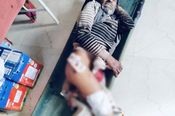 Champawat: जंगली सूअर के हमले से सिल्योरी निवासी गंभीर घायल, इलाज के लिए जिला अस्पताल चंपावत रेफर