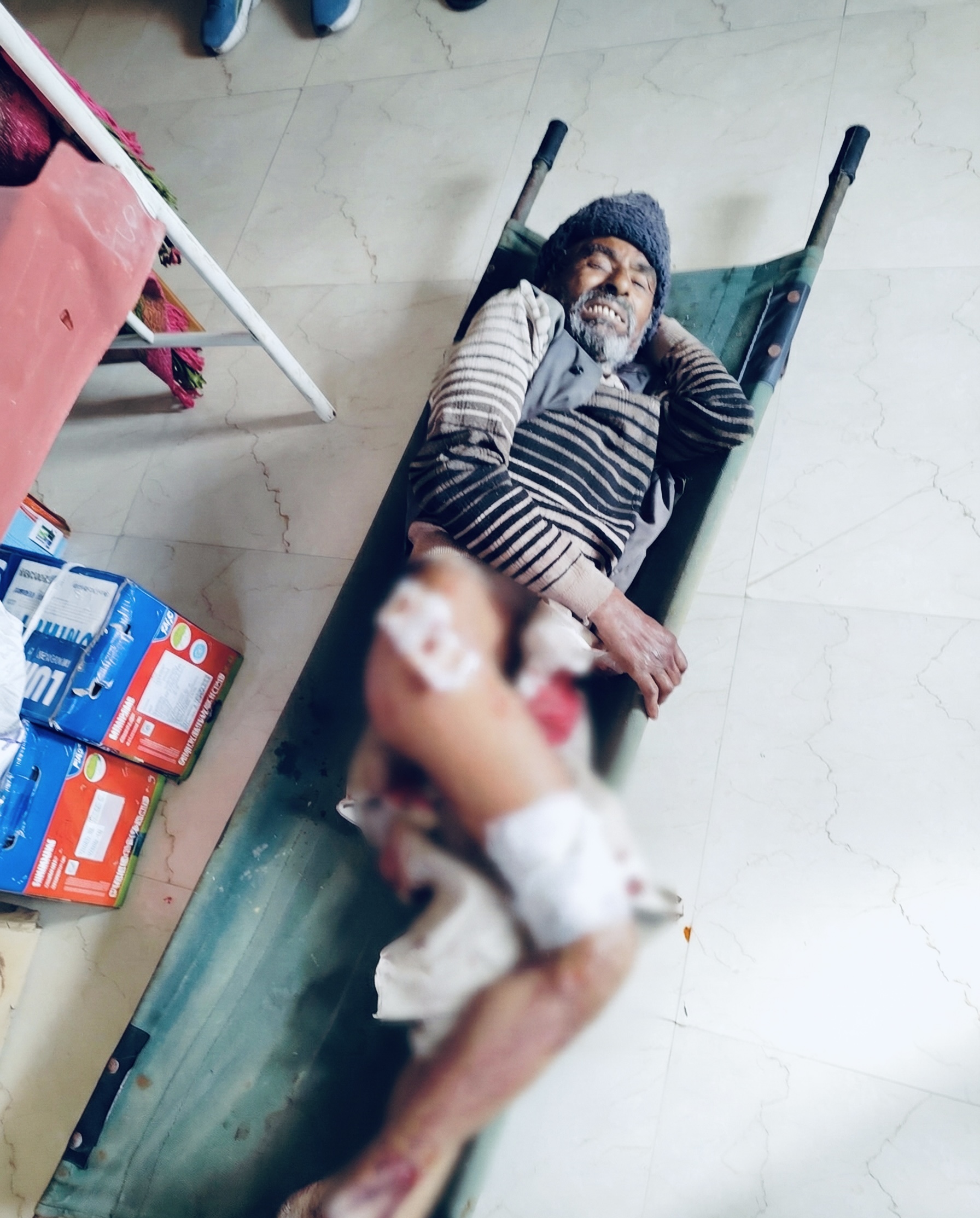 Champawat: जंगली सूअर के हमले से सिल्योरी निवासी गंभीर घायल, इलाज के लिए जिला अस्पताल चंपावत रेफर