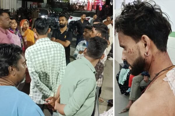 Haldwani: राजपुरा में रेट्रो साइलेंसर विवाद में युवक पर चाकू से हमला, आरोपी की गिरफ्तारी को लेकर लोगों ने हल्द्वानी कोतवाली का किया घेराव