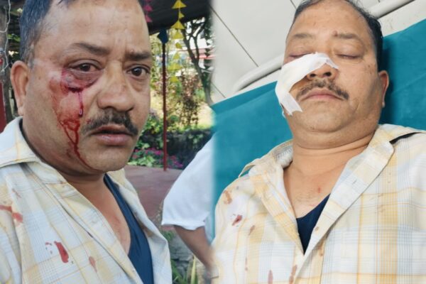 Ranibagh: रानीबाग में दिनदहाड़े पूर्व बीटीसी सदस्य एवं वर्तमान ग्राम प्रधान प्रतिनिधि पर जानलेवा हमला, लाठी-डंडों से सिर पर वार, इलाके में उबाल और सख्त कार्रवाई की मांग तेज