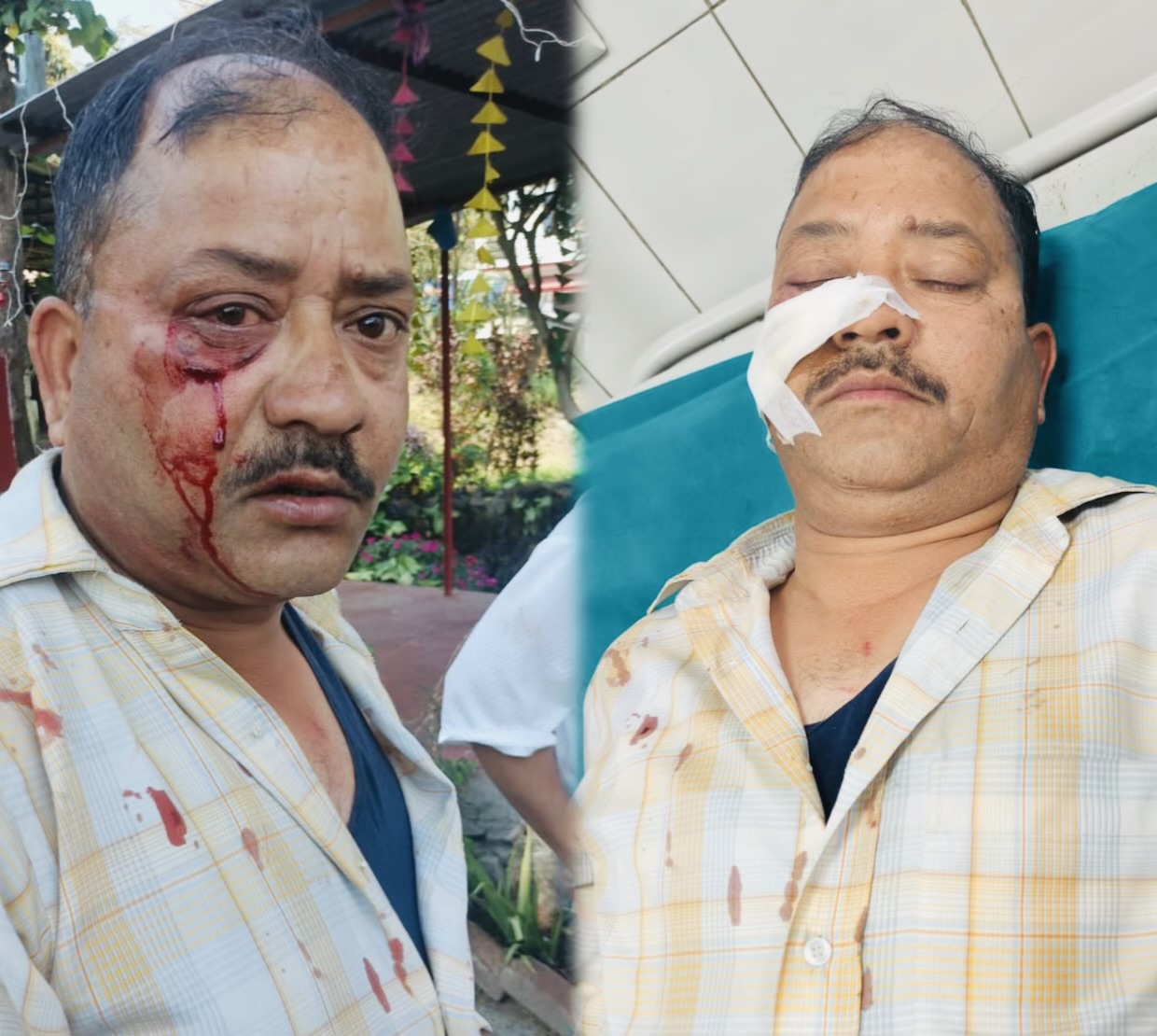 Ranibagh: रानीबाग में दिनदहाड़े पूर्व बीटीसी सदस्य एवं वर्तमान ग्राम प्रधान प्रतिनिधि पर जानलेवा हमला, लाठी-डंडों से सिर पर वार, इलाके में उबाल और सख्त कार्रवाई की मांग तेज